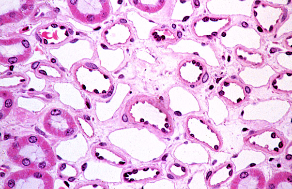  kidney, medulla, vasa recta and thin loops 