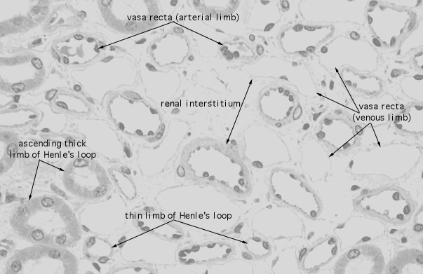  kidney, medulla, vasa recta and thin loops 