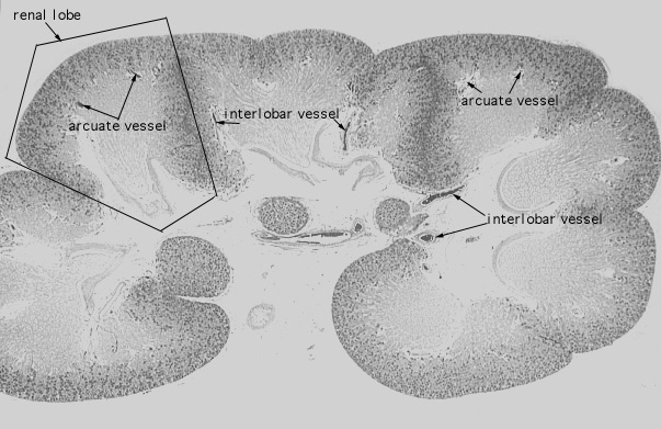  neonatal kidney, vasculature 