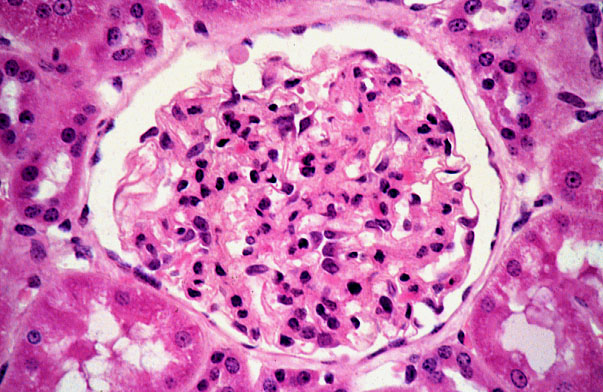  simple squamous epithelium 
