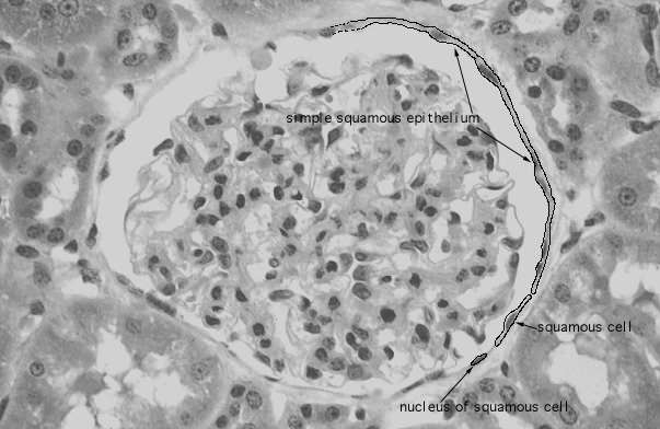 Squamous epithelium simple What Are