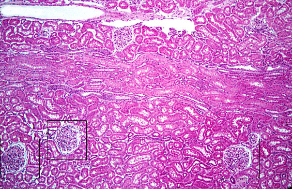  kidney, H&E, cortex and medullary ray 