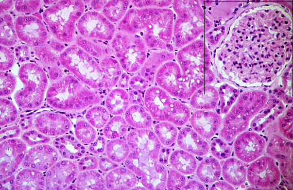  kidney, H&E, proximal/distal convoluted tubules 