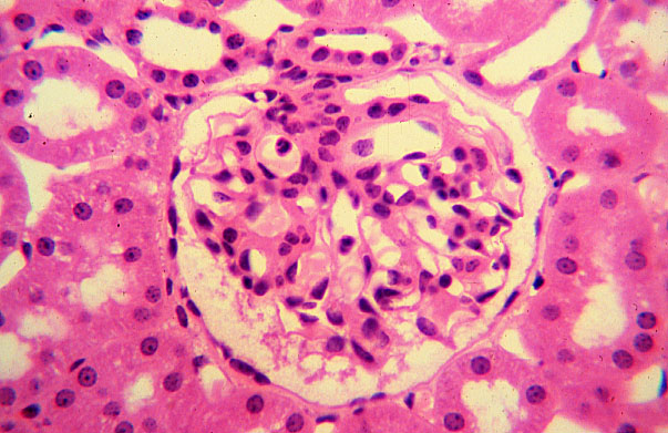 kidney, H&E, corpuscle 