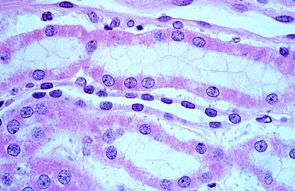  kidney, H&E, thin loop of Henle and ascending tubule 