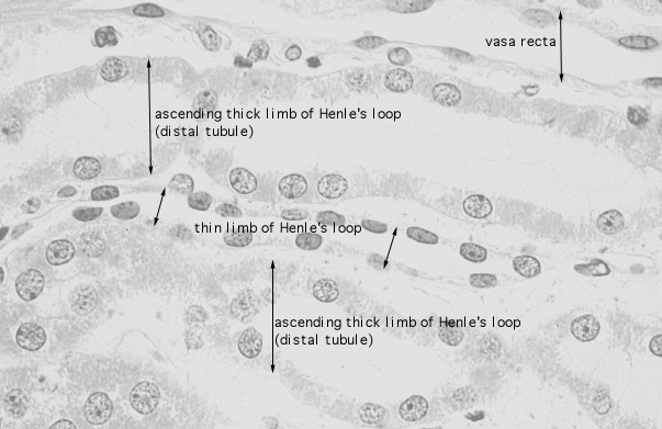  kidney, H&E, thin loop of Henle and ascending tubule 