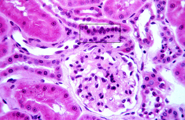  kidney, H&E, juxtaglomerular apparatus 