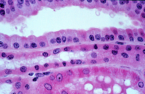  kidney, H&E, collecting duct and distal tubule 