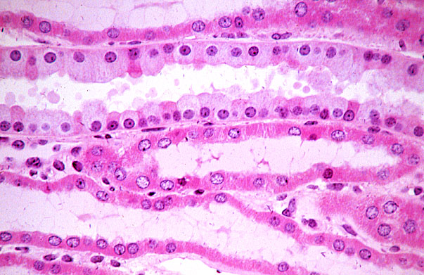  kidney, H&E, collecting duct and ascending tubule 