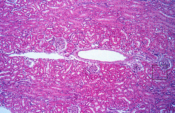  kidney, H&E, interlobular artery and vein 