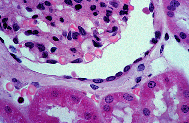  kidney, H&E, glomerular and peritubular capillaries 