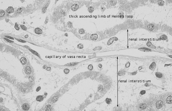  kidney, H&E, vasa recta 