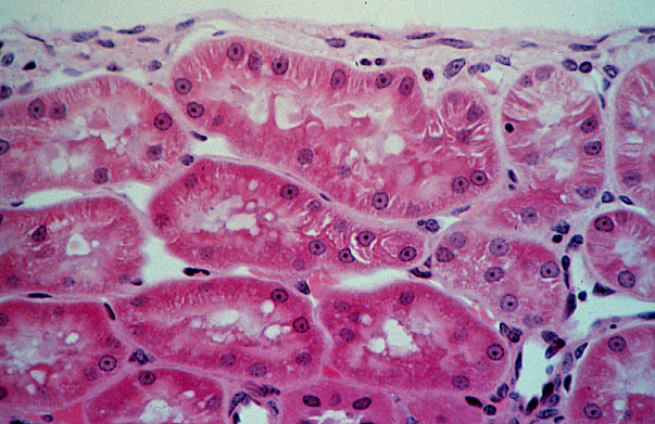  kidney, H&E, capsule and stellate veins 