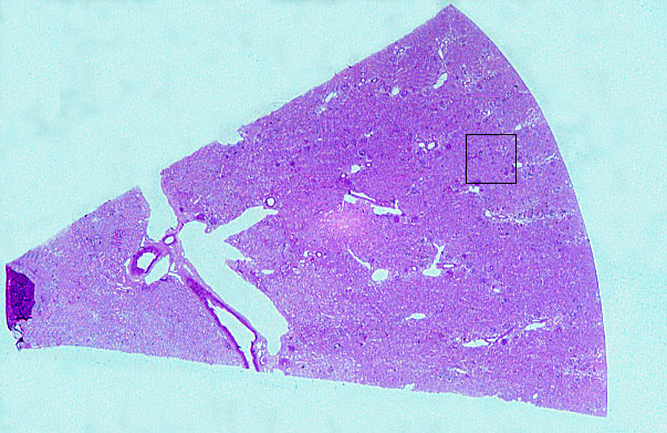  basement membrane 