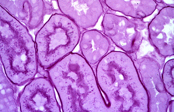  basement membrane 