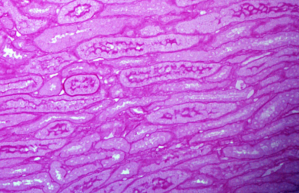  kidney, PAS stain, ascending and descending tubules 