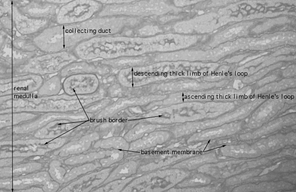  kidney, PAS stain, ascending and descending tubules 