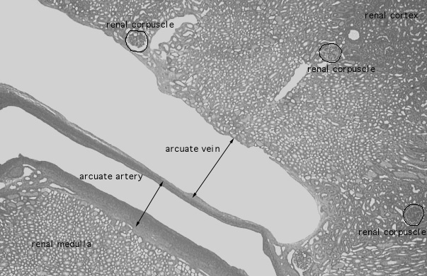  kidney, PAS stain, arcuate artery and vein, longitudinal 