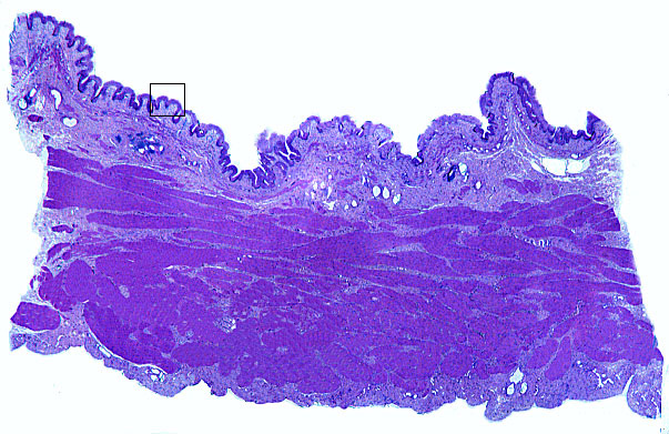  transitional epithelium, contracted 