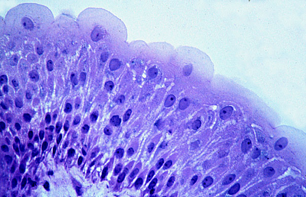  transitional epithelium, contracted 