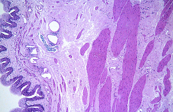  smooth muscle, other arrangements 