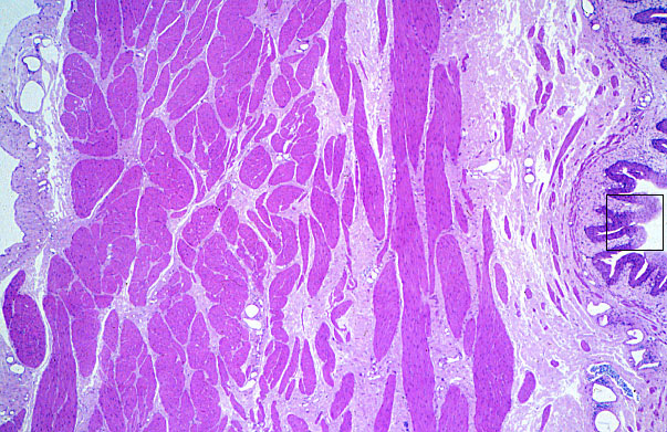  urinary bladder, relaxed 