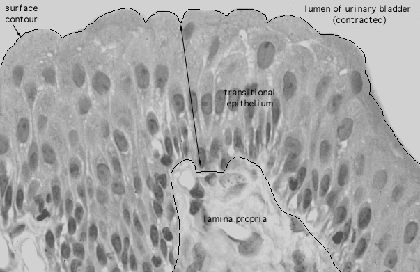  urinary bladder, transitional epithelium 