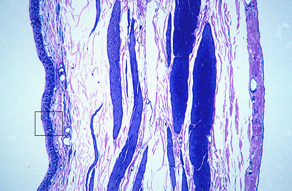  urinary bladder, distended transitional epithelium 
