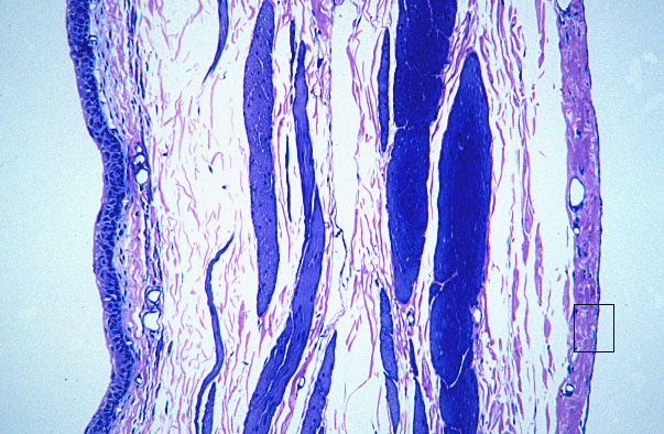  urinary bladder, mesothelium 