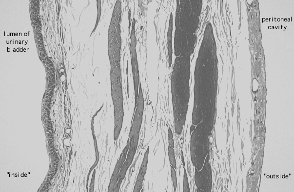  urinary bladder, distended transitional epithelium 