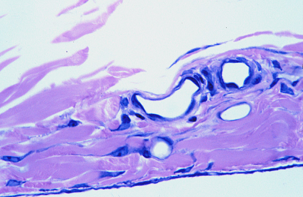  mesothelium 