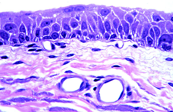 urinary bladder, transitional epithelium 