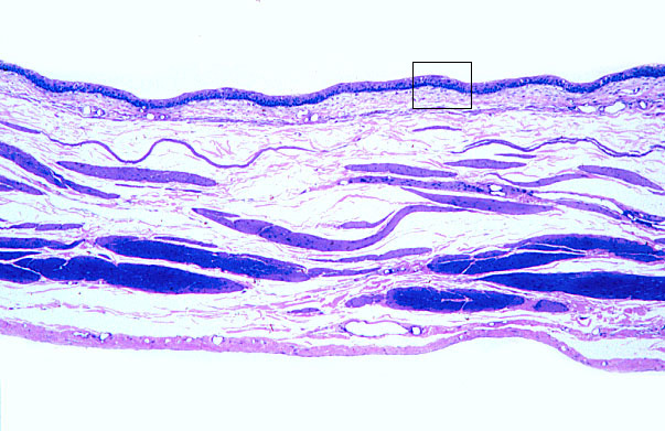  urinary bladder, distended 