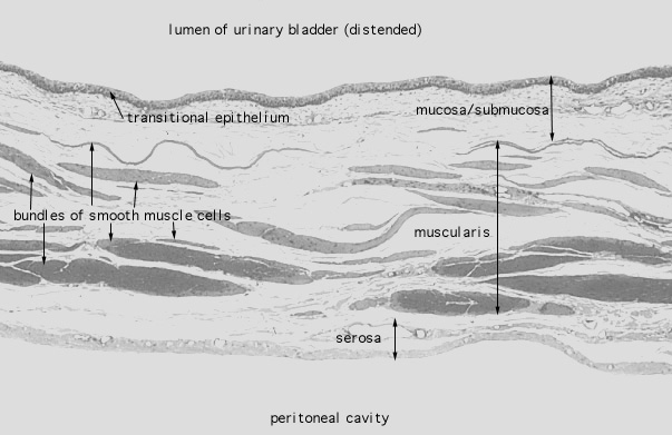  urinary bladder, distended 