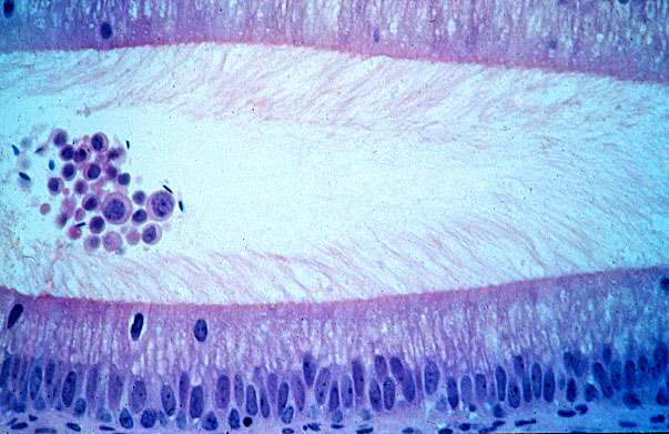  pseudostratified, stereocilia 