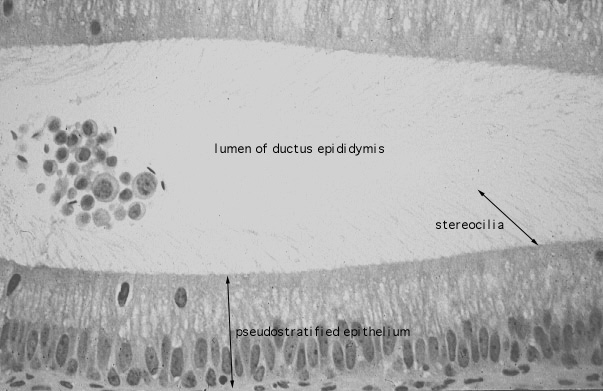  pseudostratified, stereocilia 