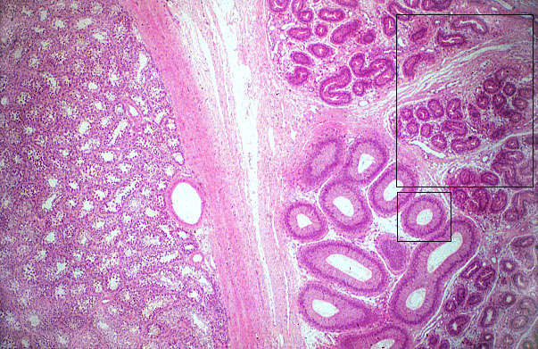 epididymis, efferent ducts 