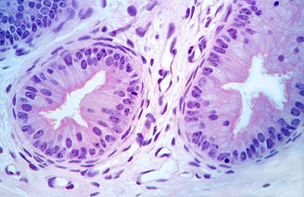  epididymis, efferent ducts 