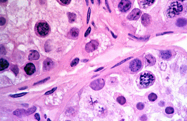  epididymis, efferent ducts, Leydig cells 