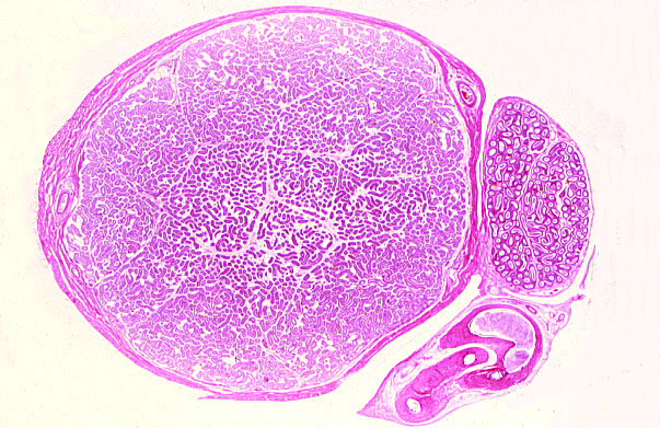  testis and epididymis 