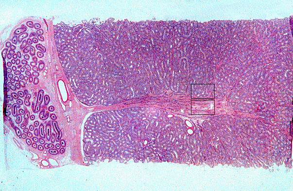  testis 