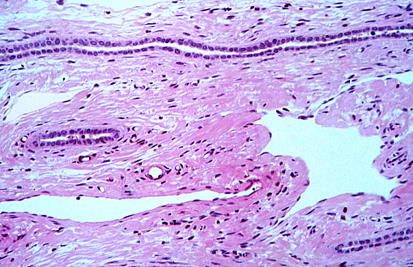  testis, rete testes and lymphatic capillaries 