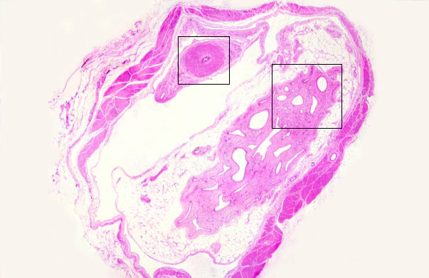  spermatic cord 