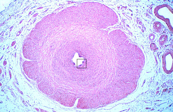  spermatic cord, ductus deferens 