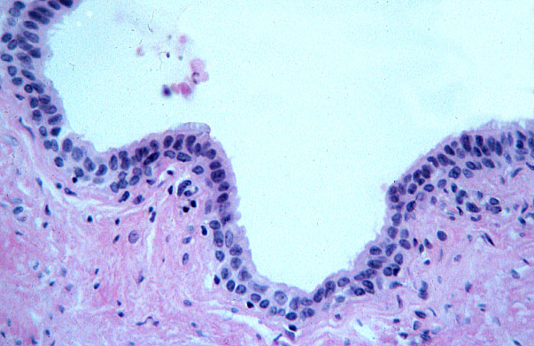  spermatic cord, ductus deferens, epithelium 