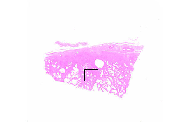  prostate gland 