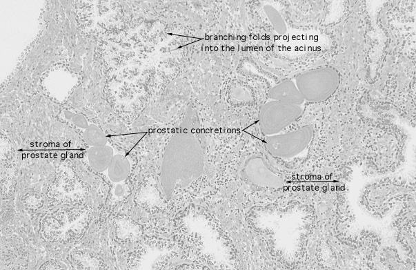  prostate, prostatic concretions 