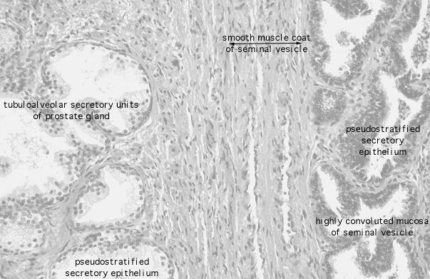  prostate, seminal vesicle 