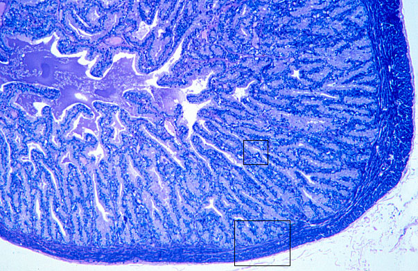  prostate, seminal vesicle 