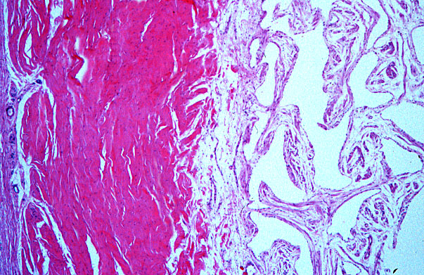  penis, tunica albuginea 